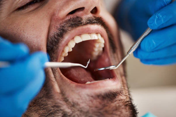 Best Emergency Root Canal Treatment in Norman, OK