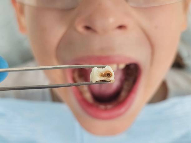 Best Cosmetic Emergency Dentistry in Norman, OK