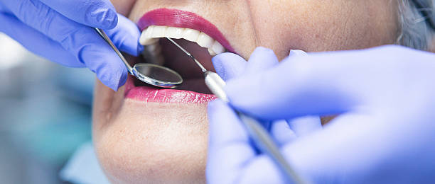 Best Emergency Tooth Extraction in Norman, OK